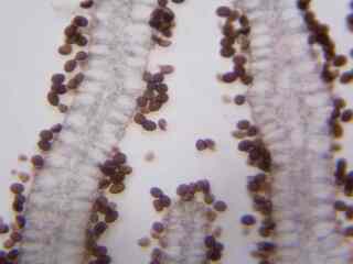 Vedci bijú na poplach. Nebezpečné améby sa šíria po celom svete, aj tam, kde by ich nikto nečakal