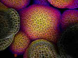 Tento molekulárny spínač pomáha rakovine prežiť nehostinné podmienky: Vedci našli spôsob, ako ho vypnúť.