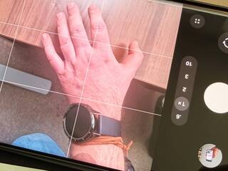 Stačí fotografia ruky a AI môže odhaliť vážne ochorenie. Diagnózu, ktorej odhalenie trvá roky, dokáže zvládnuť za sekundy