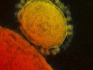 Pravdepodobne už máš v tele vírus, o ktorom si nikdy nepočul. V určitých prípadoch začne napádať mozog