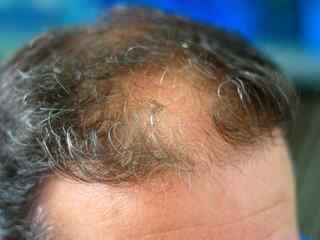 Celé roky sme sa mýlili v tom, ako rastú vlasy. Vedci odhalili mechanizmus, ktorý úplne mení doterajšie vysvetlenie