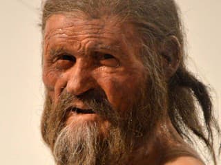 Ötzi nie je len obyčajná múmia z ľadu. Vedci v jeho tele našli mikrosvet, ktorý prežil viac než 5 000 rokov