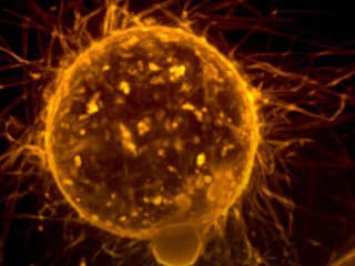 Vedci vyvinuli nový druh protilátky, ktorý efektívne bojuje proti jednej z najagresívnejších foriem rakoviny prsníka