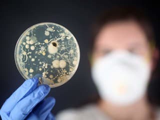 Čínska vesmírna stanica ukrývala doteraz neznámu baktériu: Jej pozemská „sestra“ dokáže spôsobiť závažné problémy