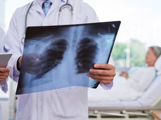 Tieto príznaky si ľudia často mýlia s chrípkou: Ide pritom o zápal pľúc!