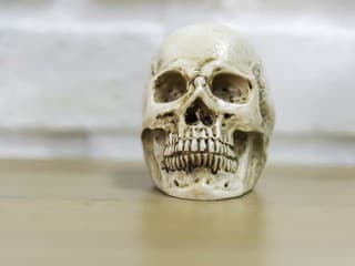 Najčastejšie zdravotné príčiny úmrtí vo svete v roku 2025: Úmrtnosť na jednu chorobu prudko stúpa!