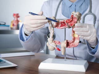 Úspech skríningu karcinómu hrubého čreva závisí od jednej zásadnej veci: Upozorňujú slovenskí zdravotníci