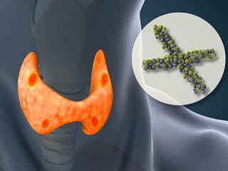 Viete doma zistiť, či štítna žľaza funguje správne? Toto si dokážete všimnúť sami