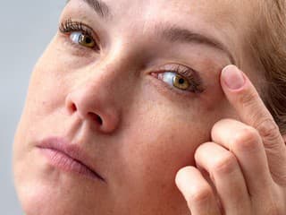 Toto sú prvé signály na očiach po 40-ke, ktoré môžu súvisieť s mozgom, pečeňou alebo cievami