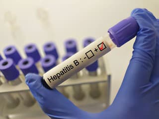 Prelom v liečbe hepatitídy B: Nový liek priniesol zabral u každého piateho pacienta!