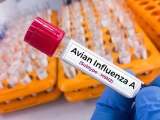 V Európe potvrdili prvý ľudský prípad vtáčej chrípky H9N2: Čo nám hrozí?