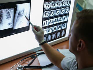 Jedna z najnebezpečnejších druhov rakoviny: Tieto príznaky často prehliadame