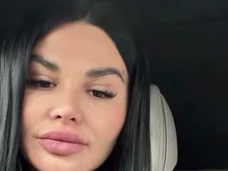 Zuzanu Plačkovú čaká sekcia