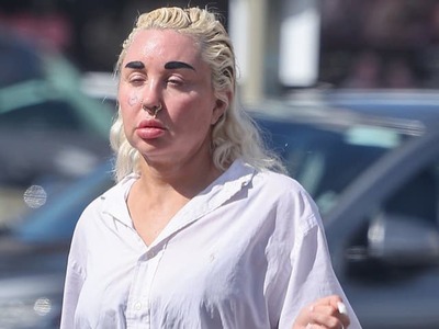 Jej krása je nenávratne preč! Amanda Bynes (40) kedysi patrila medzi najväčšie tínedžerské hviezdy Hollywoodu. Dnes pohľad na ňu šokuje. Bývalá herečka púta pozornosť extravagantným vzhľadom a po nežnej kráske z niet ani stopy!