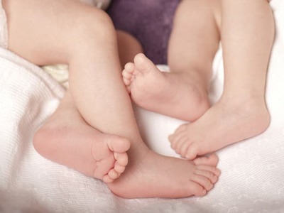 Siamské dvojičky, ktoré sa na Slovensku narodili tento rok v júni, oddelia lekári v Saudskej Arábii. Televízii Markíza to povedala matka oboch dievčat, ktoré sú spojené panvami. Špecializovaná nemocnica v Rijáde už podľa televízie oddelila 70 siamských dvojčiat a tento program financuje Saudská Arábia.