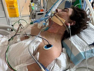 PERTH – Obyčajné upratovanie sa zmenilo na boj o život. Mladý Austrálčan utrpel rozsiahle popáleniny po tom, ako v jeho kuchyni explodoval robotický vysávač a následne zachvátil dom požiar.