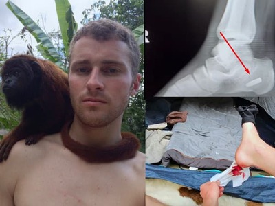 ETIÓPIA – Dobrodruh Charles cestuje už dlhú dobu po rôznych krajinách sveta. To, čo sa mu prihodilo v Afrike, ale hraničilo so smrťou. Charles však ukázal, že má z ocele nielen nervy. Auto dokázal šoférovať celý deň a to mal nohu zlomenú na dvoch miestach.