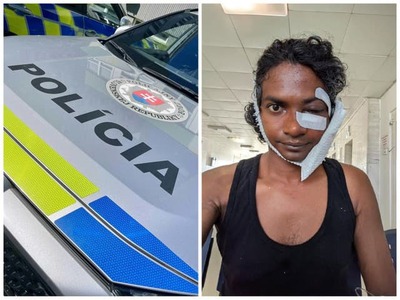 Útok na skupinu Indov v Nitre bude vyšetrovať odbor kriminálnej polície Krajského riaditeľstva (KR) Policajného zboru (PZ) v Nitre ako zločin ublíženia na zdraví spáchaný z osobitného motívu z nenávisti pre príslušnosť k rase alebo národu a prečin výtržníctva. Pôvodne bola udalosť evidovaná na obvodnom oddelení PZ Nitra - západ ako priestupok proti občianskemu spolunažívaniu, potvrdil hovorca KR PZ Nitra Tomáš Havetta.