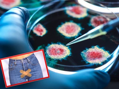 LONDÝN/BERLÍN/PARÍŽ – Európsky kontinent trápia uprostred letnej dovolenkovej sezóny vírusy a infekcie, ktoré sú rezistentné na antibiotickú liečbu. Navyše ide o pohlavne prenosnú chorobu. Problém avizujú zdravotníci vo viacerých krajinách Európy.