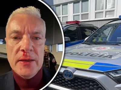 Policajné vyšetrovanie prípadu okolo dobitia poslanca Jána Ferenčáka priamo na ulici v Kežmarku sa po týždňoch významne pohlo. Orgány zákona oznámili zásadnú novinku.