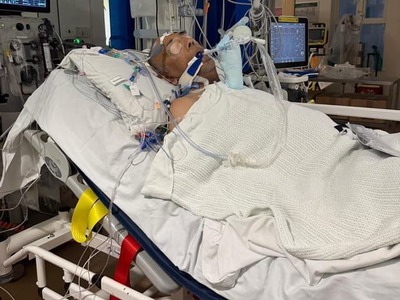 LONDÝN – Mal to byť obyčajný obed v reštaurácii. Udhyam Amin si dal pečené kurča, netušiac, že o niekoľko dní bude bojovať o život. Otrava jedlom u 64-ročného Brita prerástla do sepsy, zlyhávali mu životne dôležité orgány a zastavilo sa mu srdce. Lekári jeho rodinu pripravovali na najhoršie – podľa nich mu mohlo zostávať už iba niekoľko hodín. Amin však prežil a po viac ako dvoch týždňoch v umelom spánku sa musel znovu naučiť chodiť aj poriadne rozprávať.