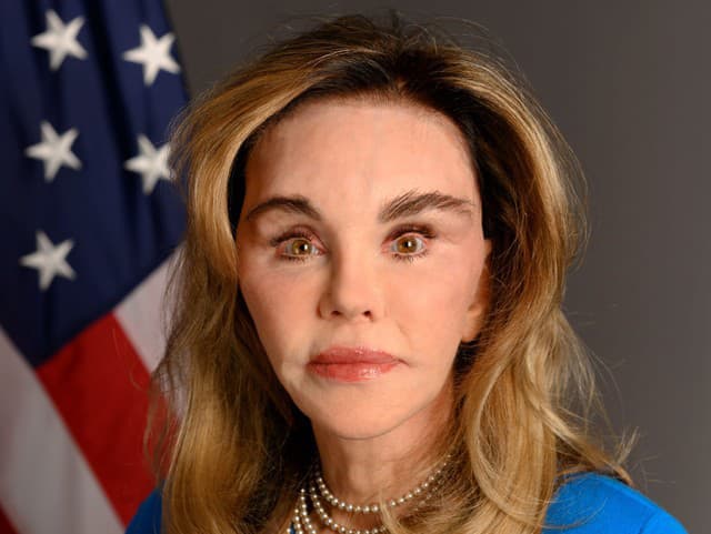 Trumpova nová veľvyslankyňa vyvolala búrlivé debaty: Stačila jedna FOTO! Je vôbec skutočná?