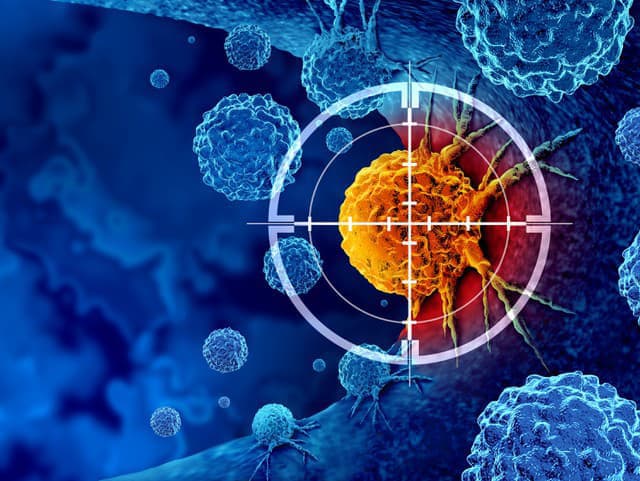 Prevratný objav dáva nádej: Nový krvný test odhalí rakovinu pankreasu už v ranom štádiu