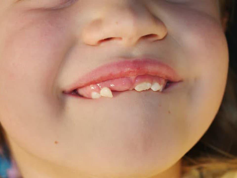 Zlé zuby nie sú genetika: Čo o kazoch a ústnej hygiene prezrádza zubárka!