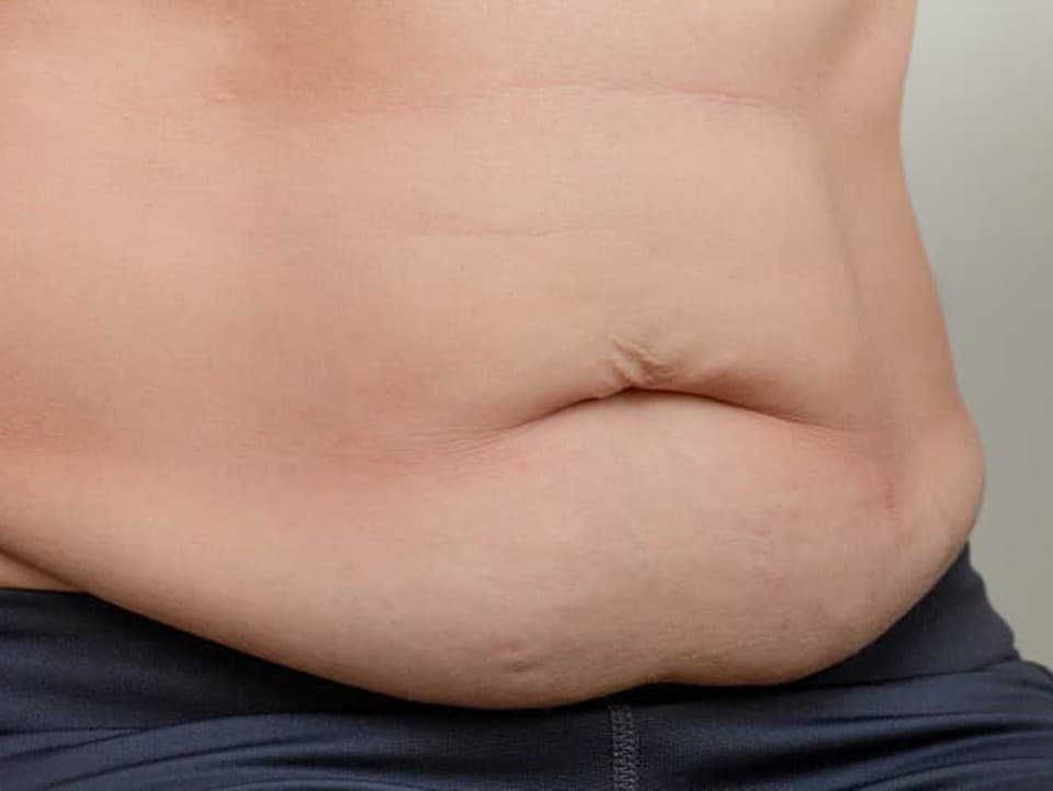 Najčastejšie omyly pri redukcii viscerálneho tuku: Niekedy pomáha robiť opak toho, čo si myslíte