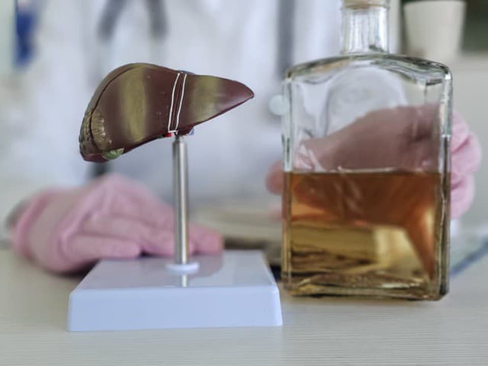 M. Šelc: Silymarín nás neuchráni od cirhózy, ak neprestaneme piť alkohol