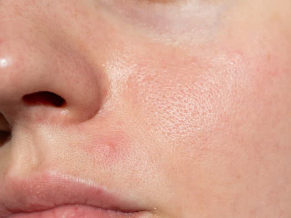 Robíte všetko a pleť je stále problémová? Toto sú možné príčiny