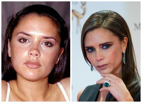 Victoria Beckham si nechala