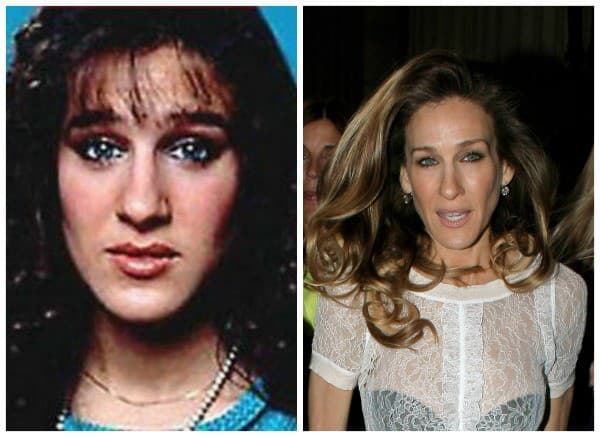 Sarah Jessica Parker podstúpila