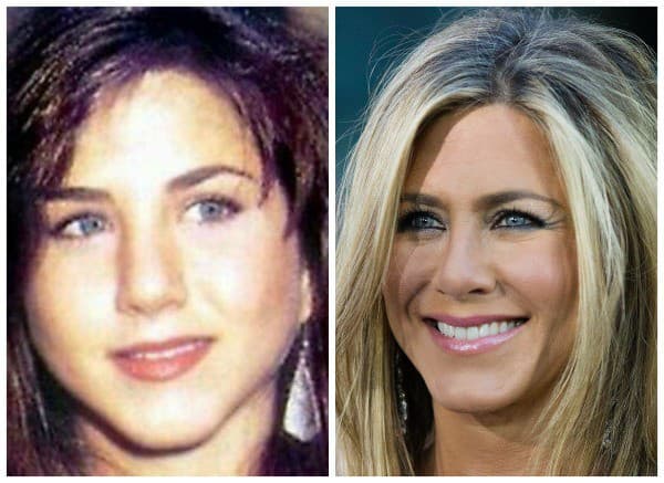 Jennifer Aniston mala komplexy