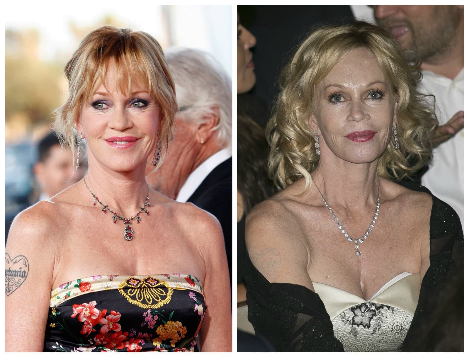 Melanie Griffith si plastikami