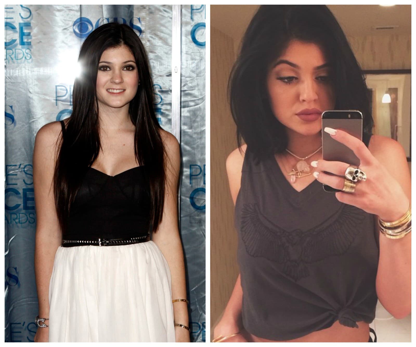 Premena Kylie Jenner sa