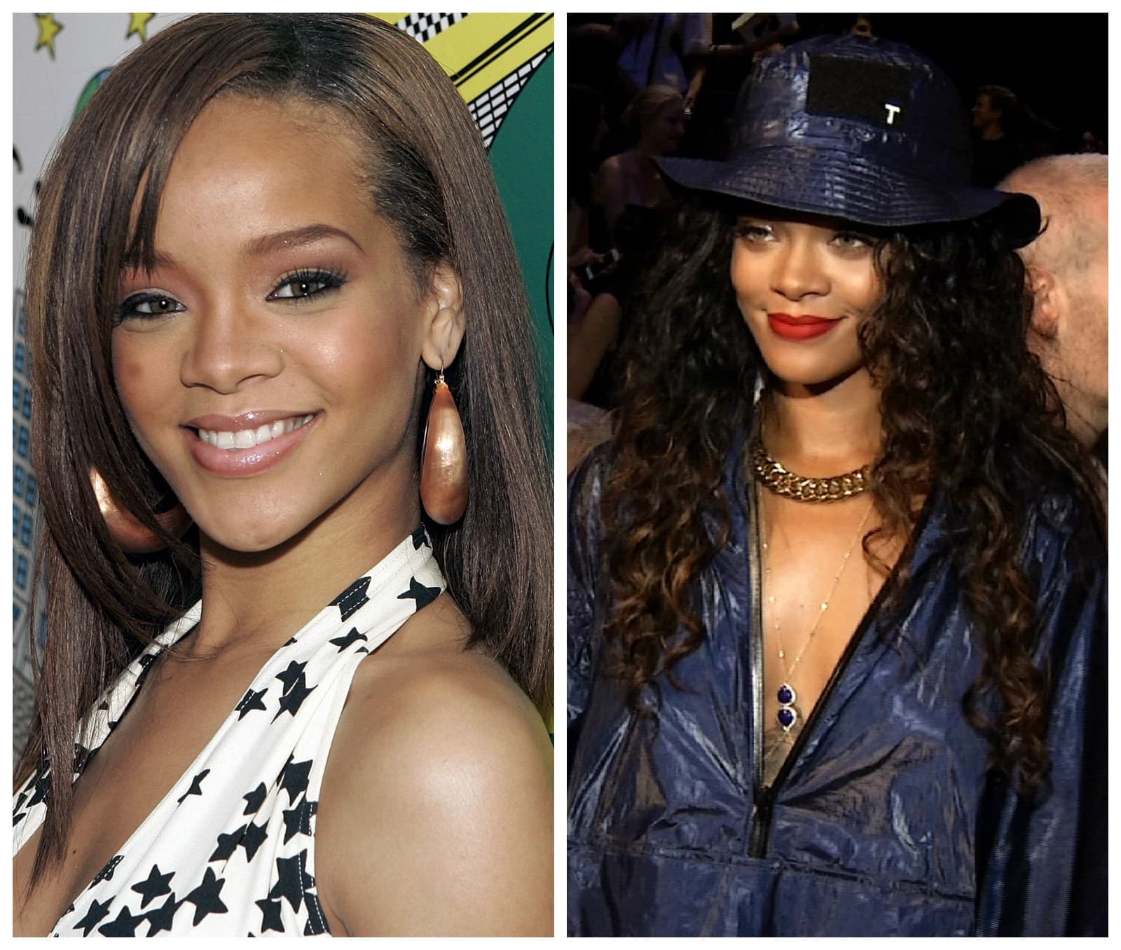 Rihanna prešla vylepšeniami, dnes