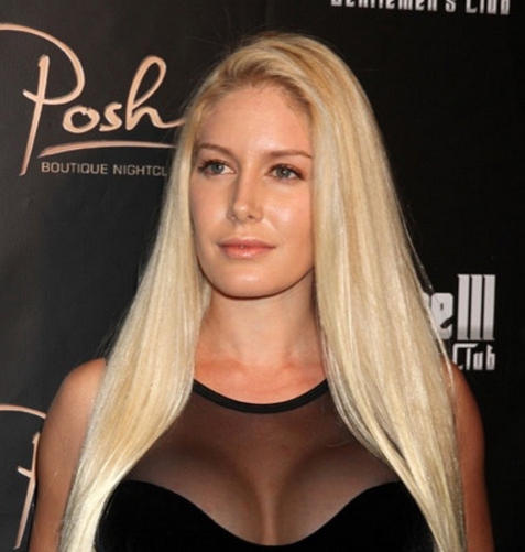 Heidi Montag dodnes ľutuje,