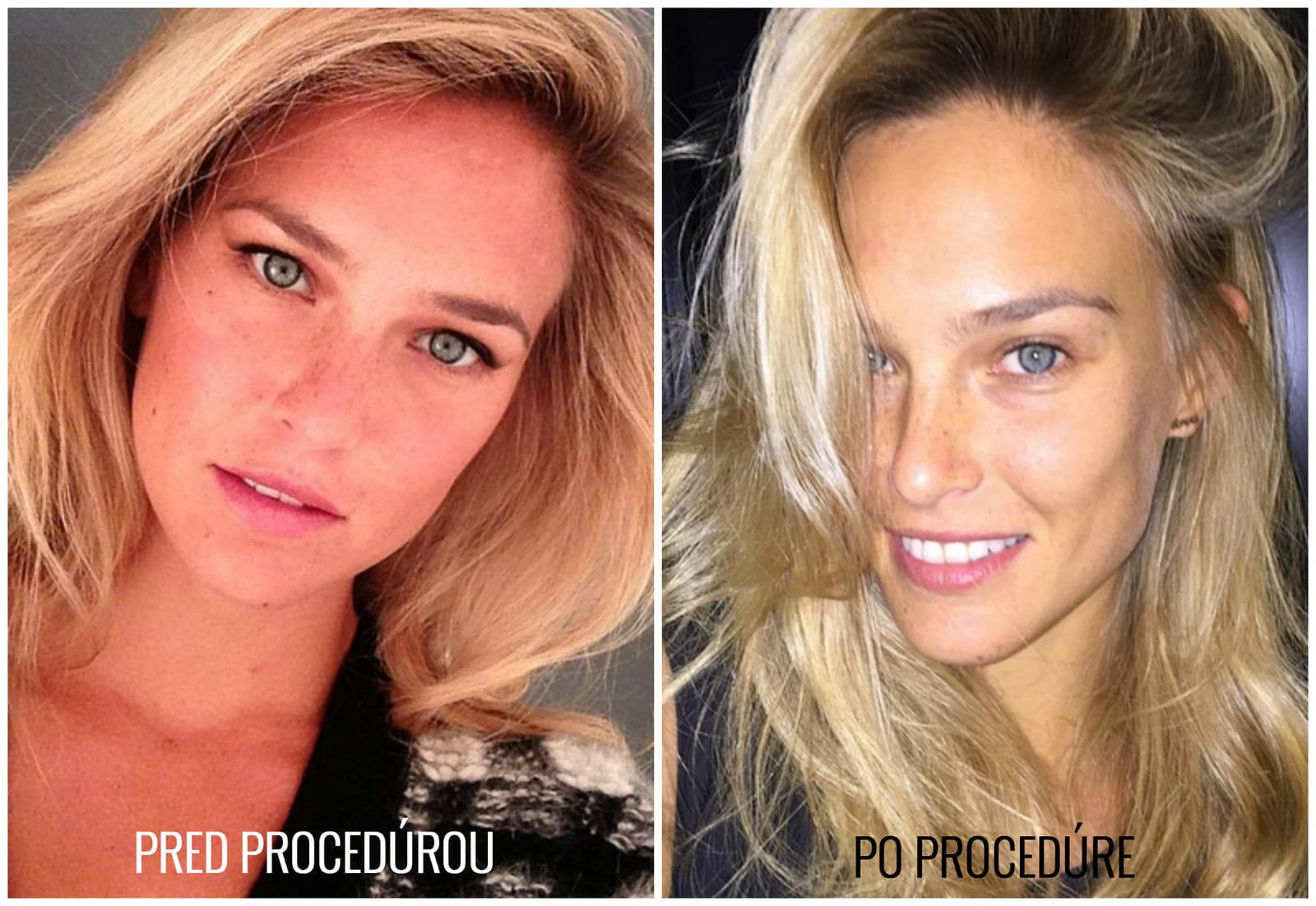 Bar Refaeli sa po