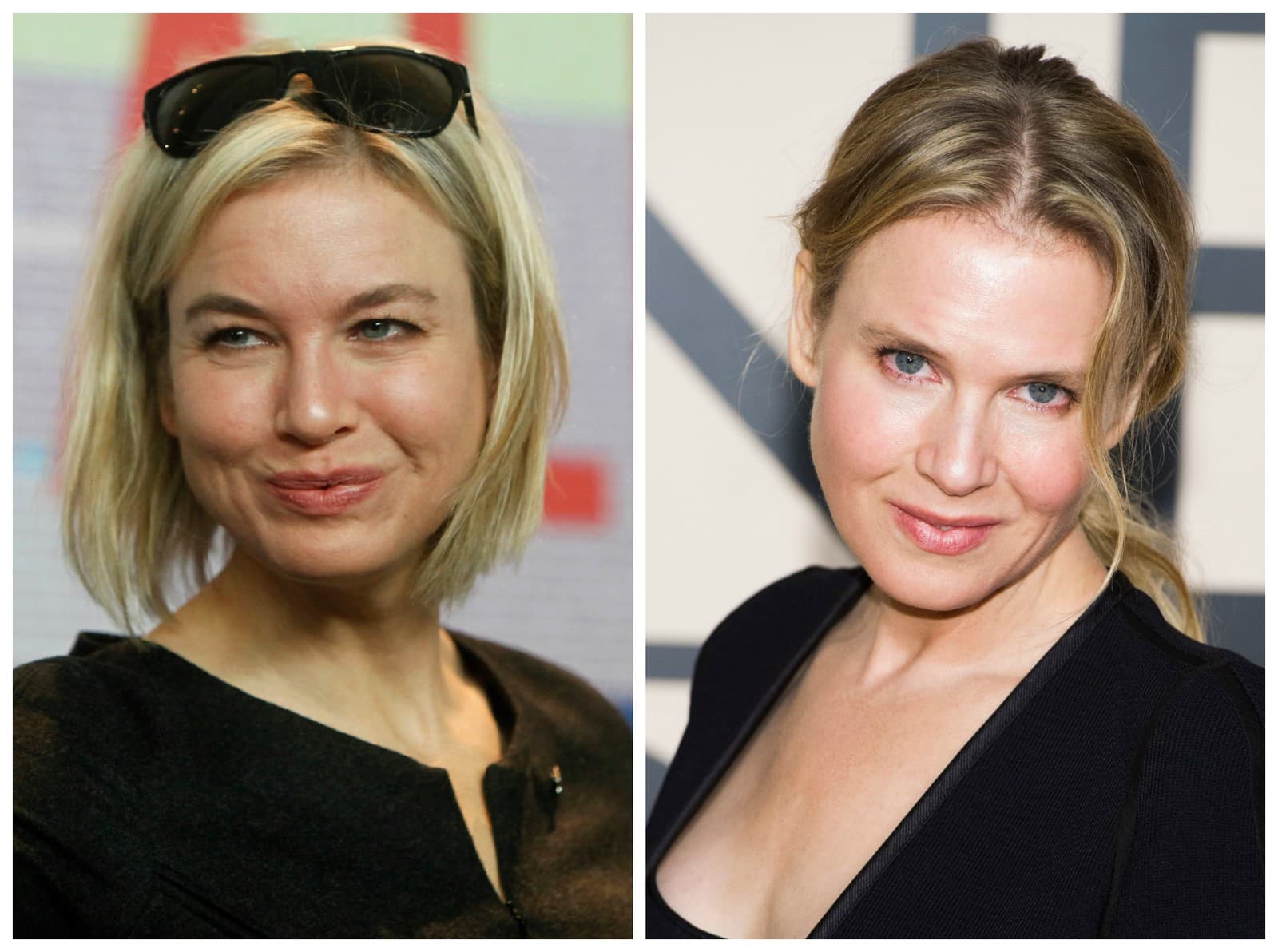 Reneé Zellweger čelí ostrej