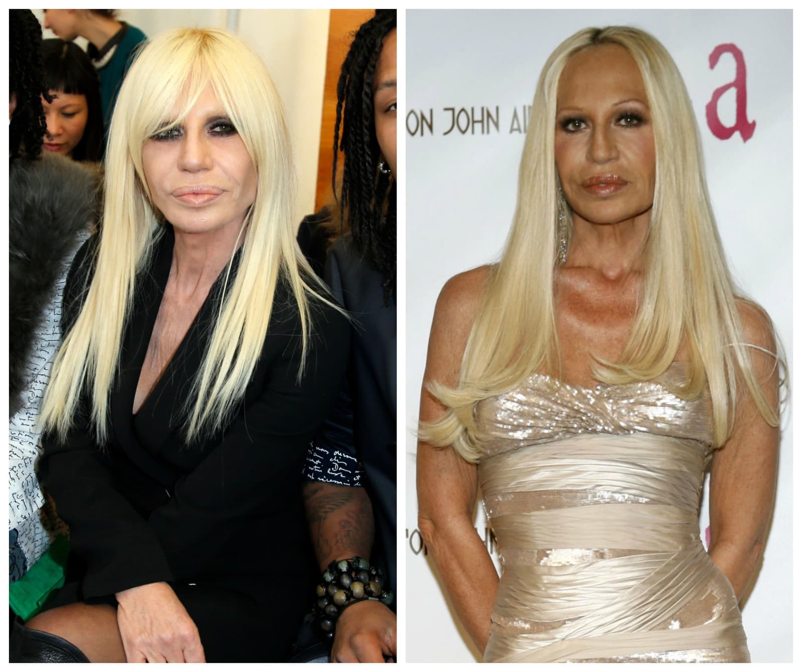 Návrhárka Donatella Versace sa