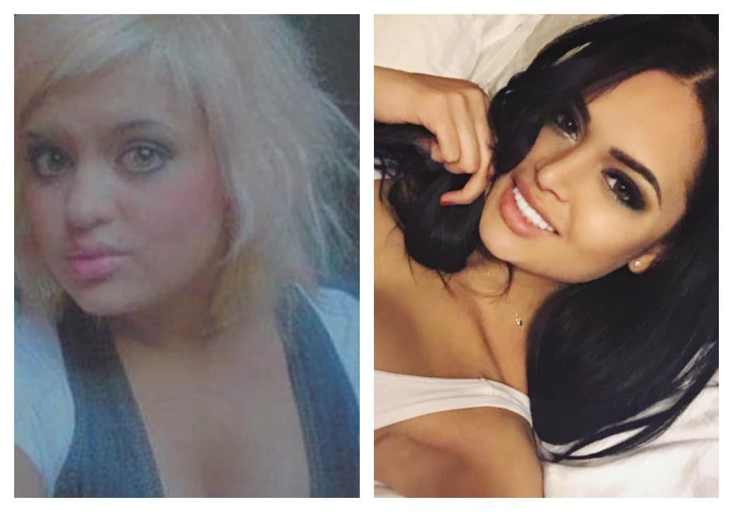 Nita Kuzmina podstúpila zákroky,