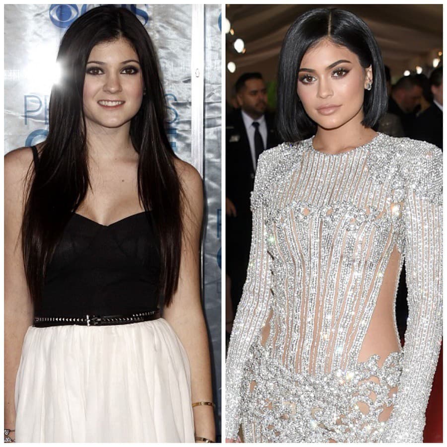 Kylie Jenner svojou premenou