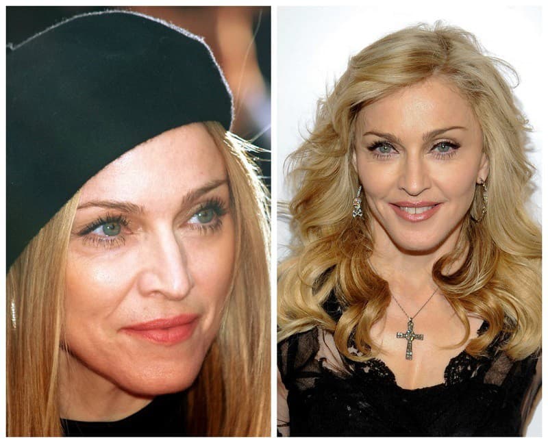 Speváčka Madonna pred, a