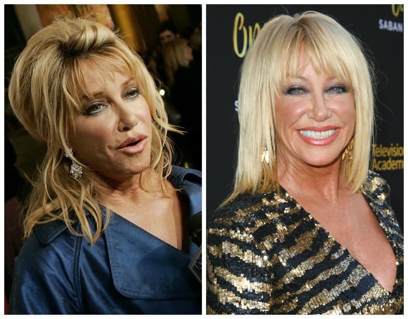 Herečka Suzanne Somers