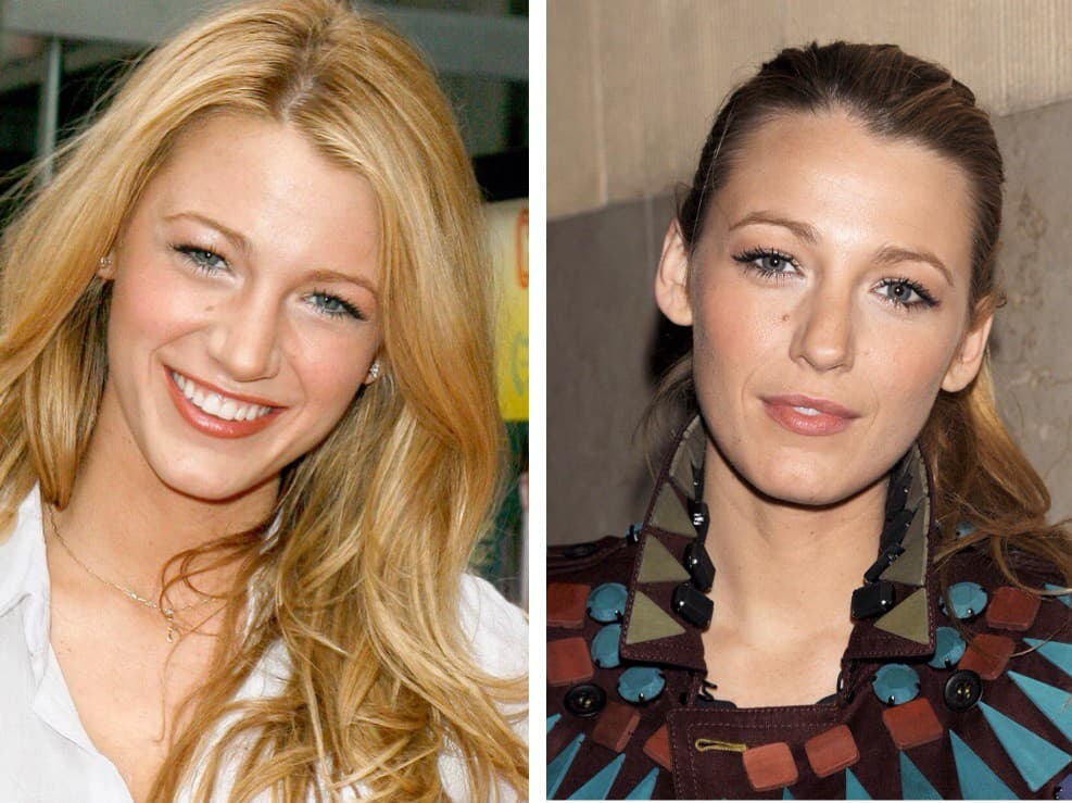 Aj Blake Lively má