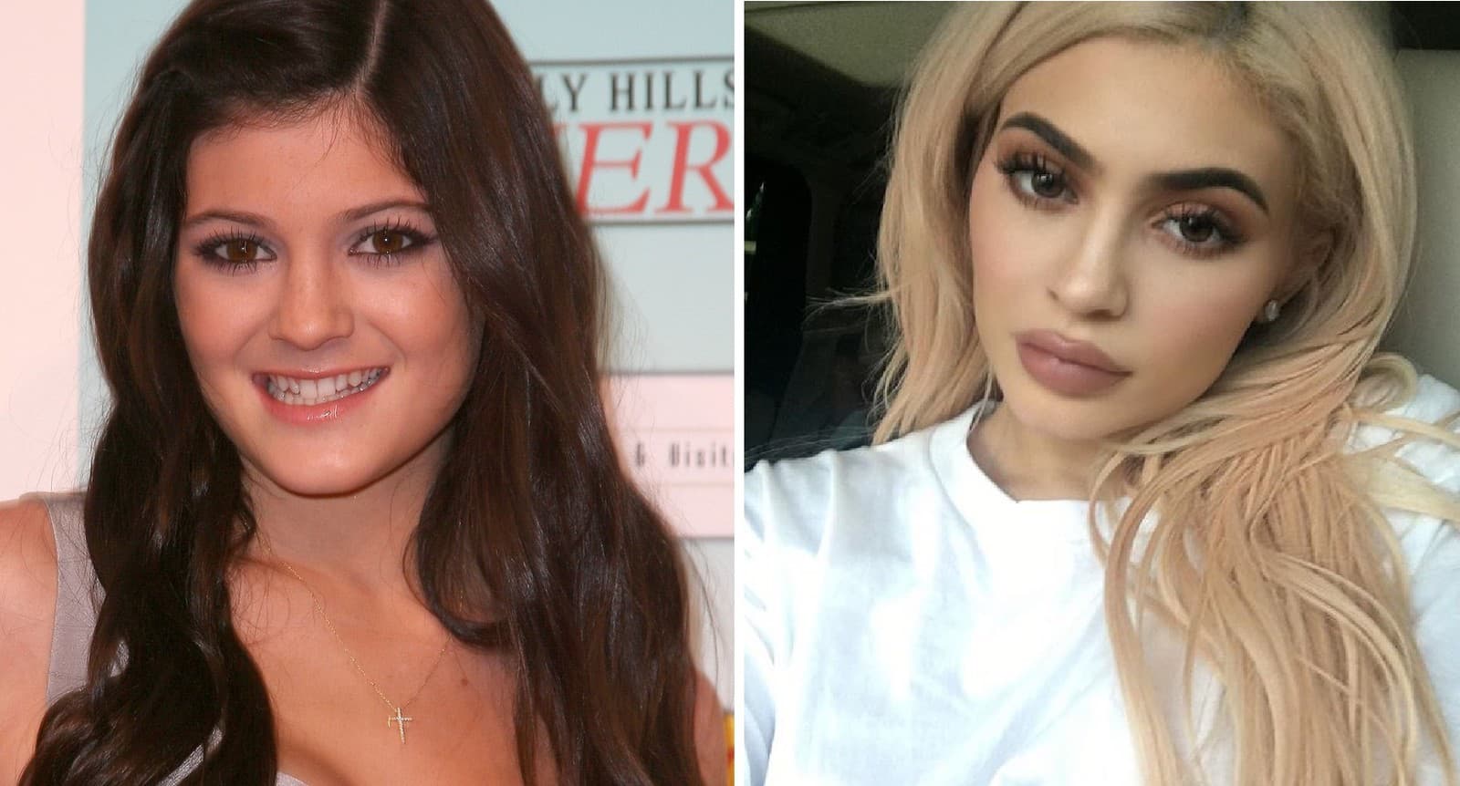 Kylie Jenner roky klamala