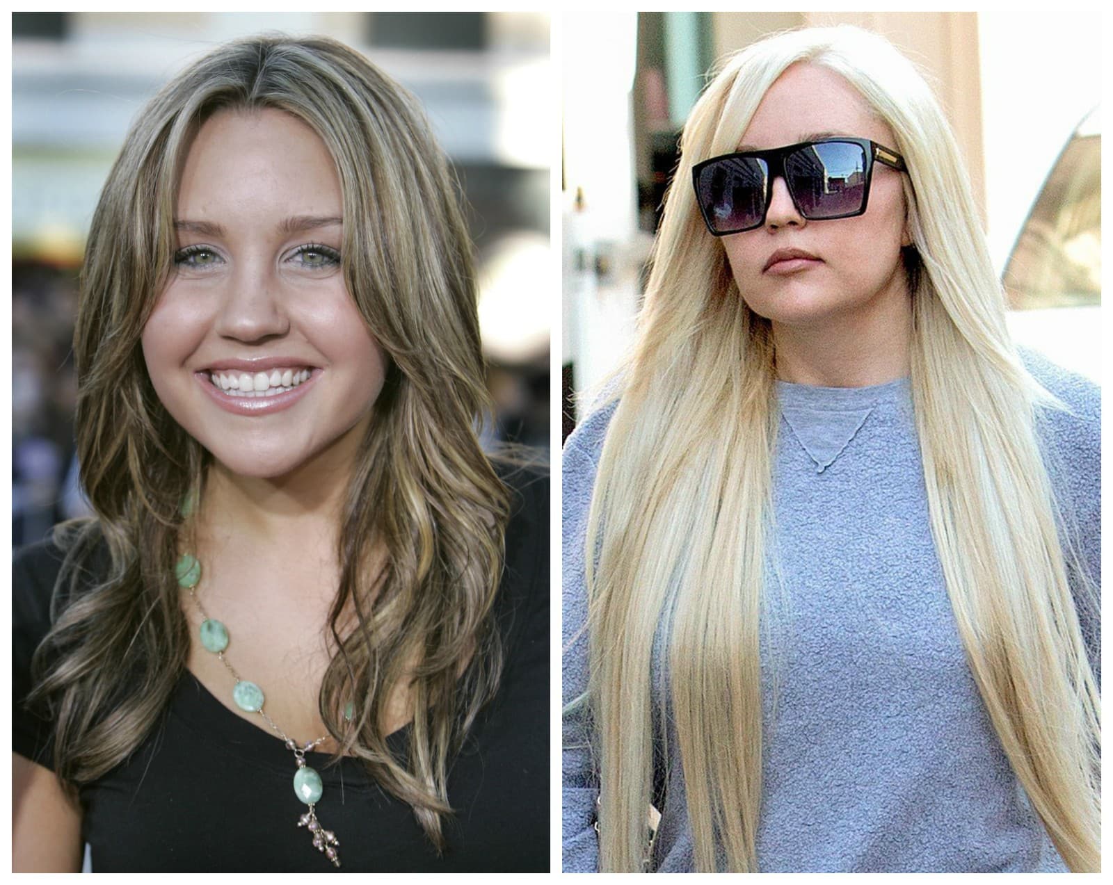 Amanda Bynes podstúpila plastickú