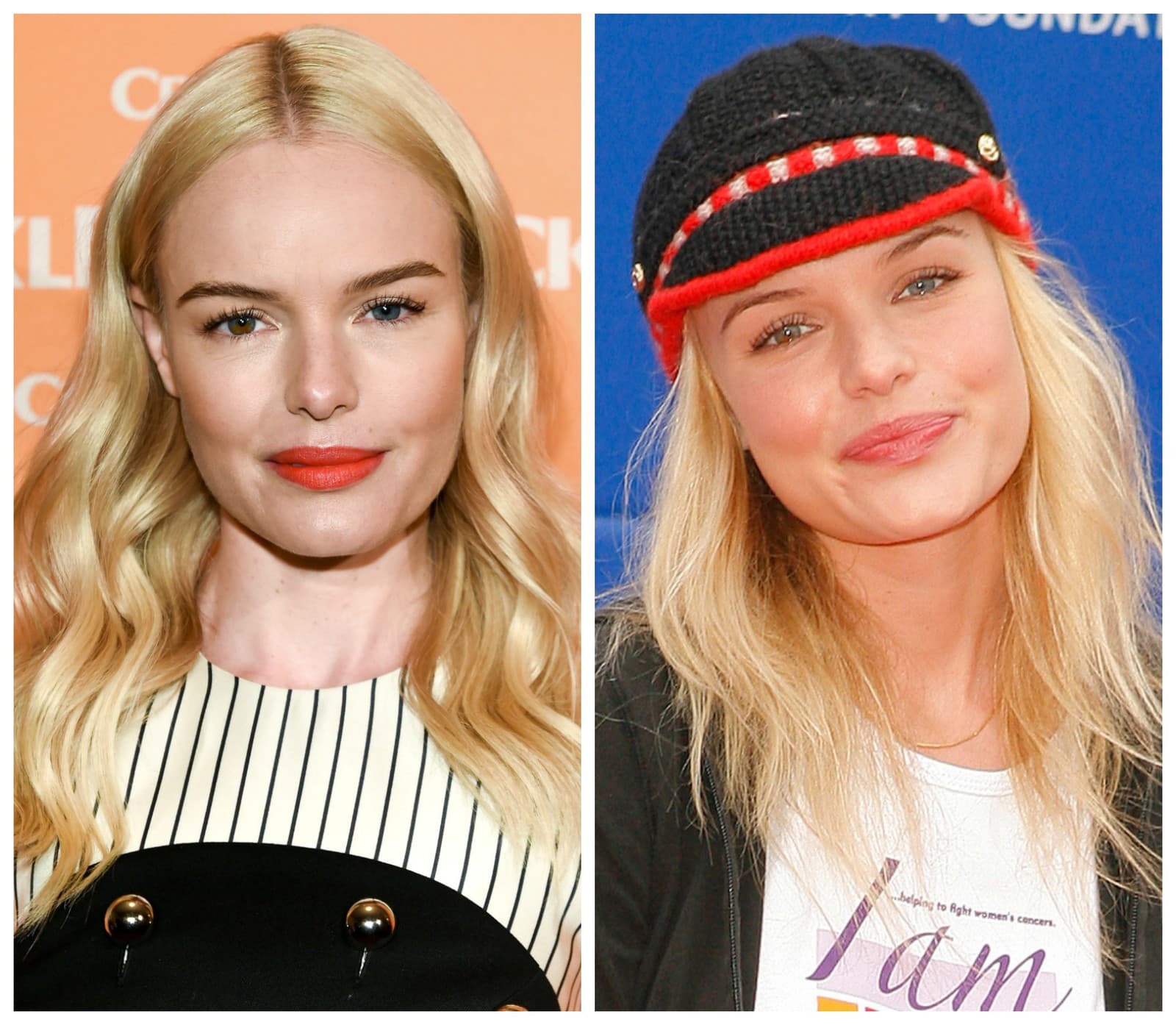 Kate Bosworth podstúpila zmenu
