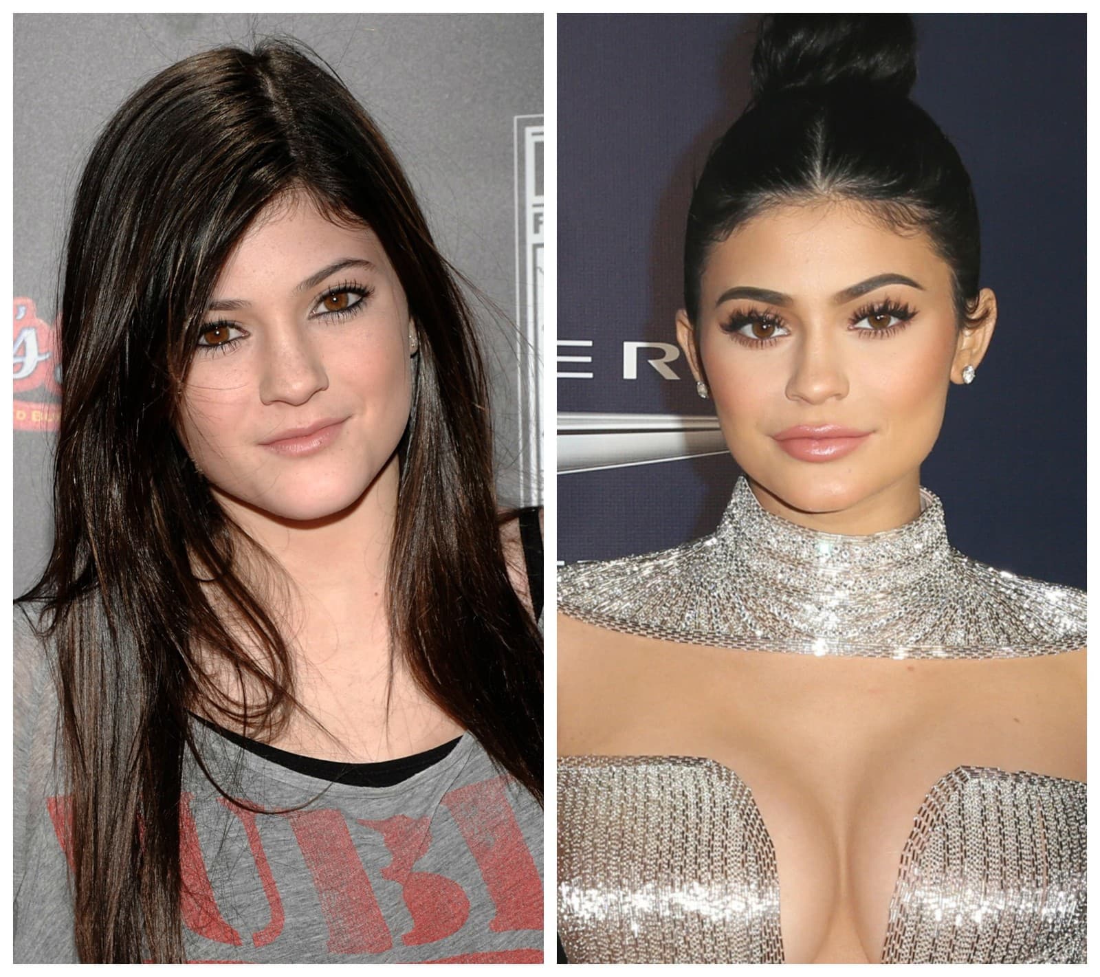 Modelka Kylie Jenner pred